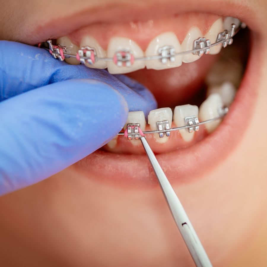 Guiding the journey of orthodontic treatment involves more than just getting your braces fitted.
