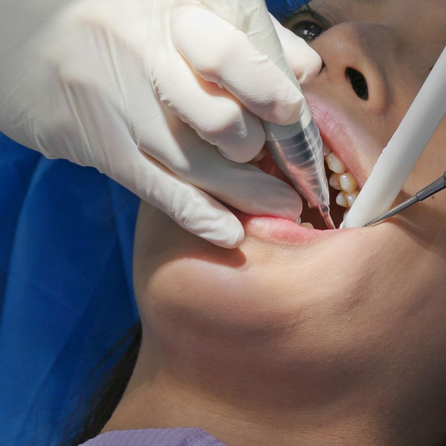 Taking the journey toward ideal gum health, one of the key milestones is the scaling and root planing procedure.