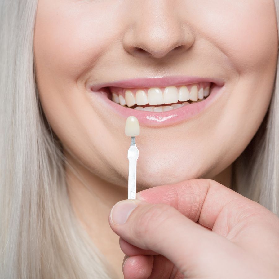 Once your porcelain veneers are in place, it's important to take proper care of them to guarantee they last and continue to provide that radiant smile you love.