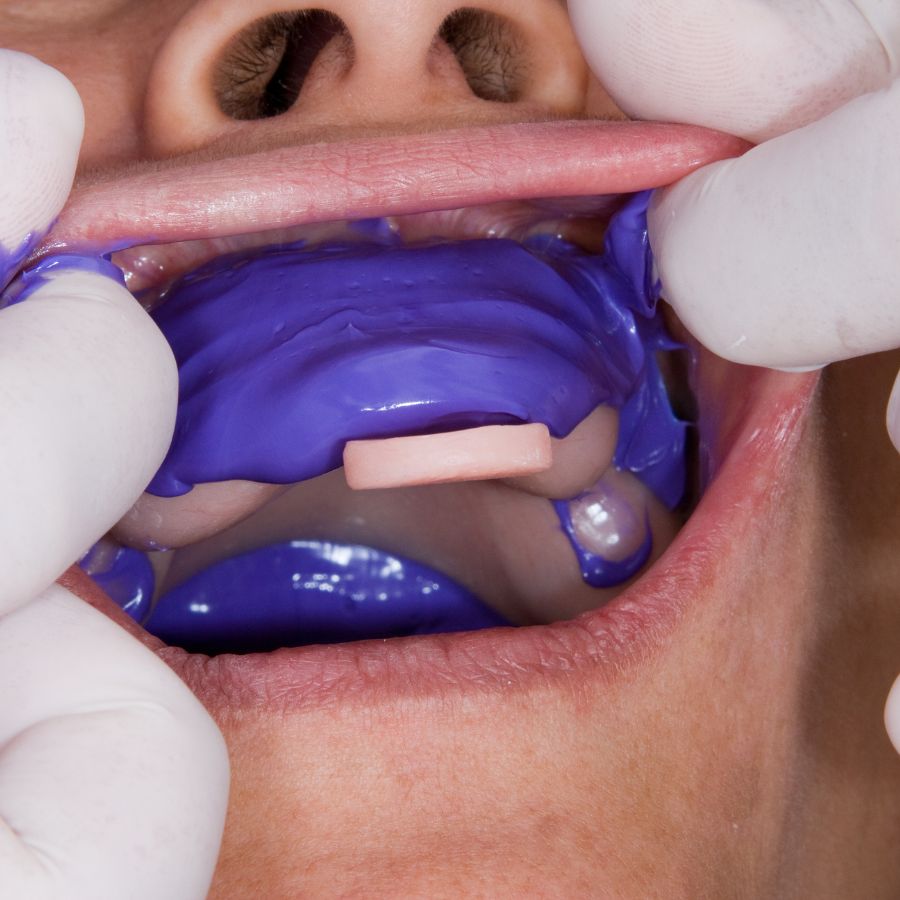 Blending restorative and cosmetic procedures is our approach to achieving a healthy and beautiful smile for you.