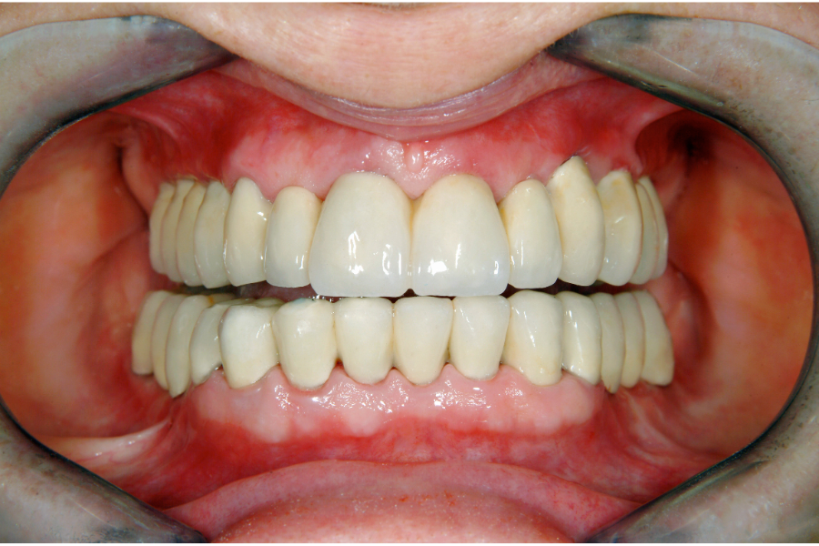 At ROC Dental in Burton, SC, we’re passionate about offering the highest quality dental care that fits your budget.