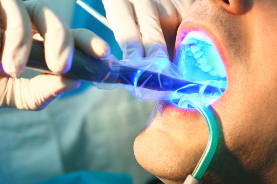 At ROC Dental in Fripp Island, SC, we offer extensive dental services, tailored to your unique needs.
