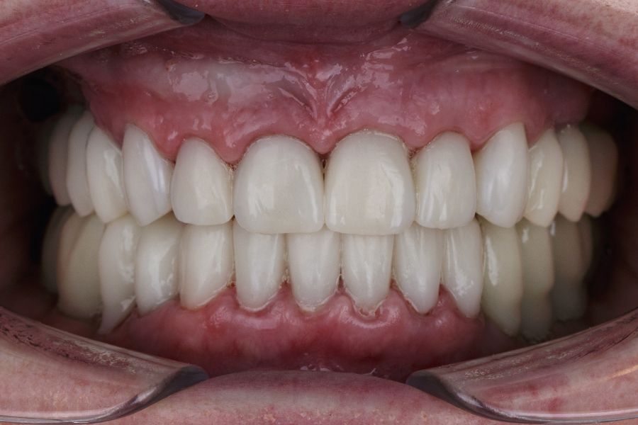 At ROC Dental, Harbor Island, SC, we’re committed to delivering exceptional dental services tailored to your needs.