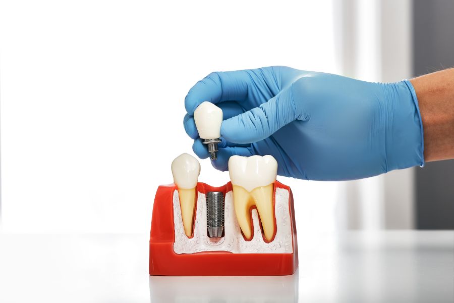 At ROC DENTAL in Lobeco, SC, we provide a variety of dental services tailored to meet your specific needs.