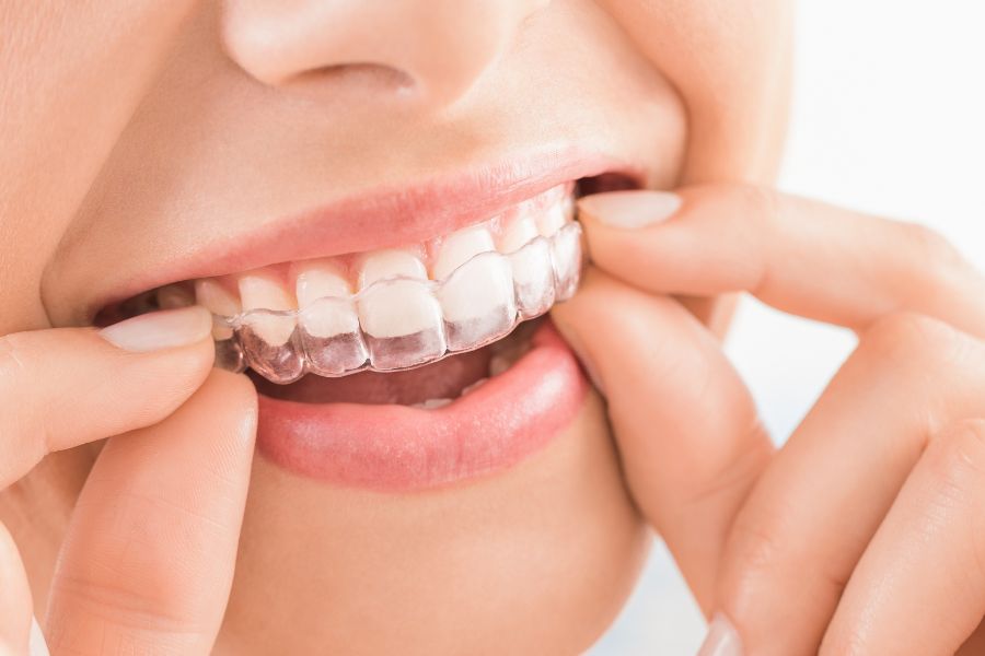 At ROC Dental in Seabrook, SC, we ensure your dental needs are met, showcasing an extensive range of services from general dentistry to intricate cosmetic procedures.