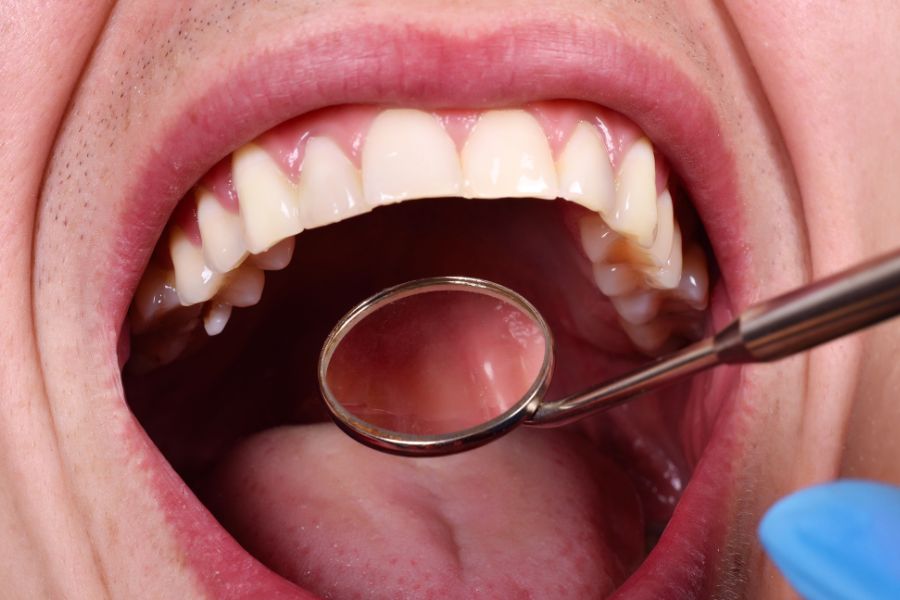 At ROC Dental in Sun City, SC, we’re committed to providing high-quality dental services tailored to our patients’ needs.