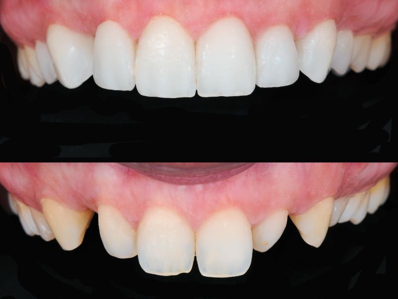At ROC Dental Group, we're not just enhancing smiles; we're boosting confidence, one digital smile design at a time.