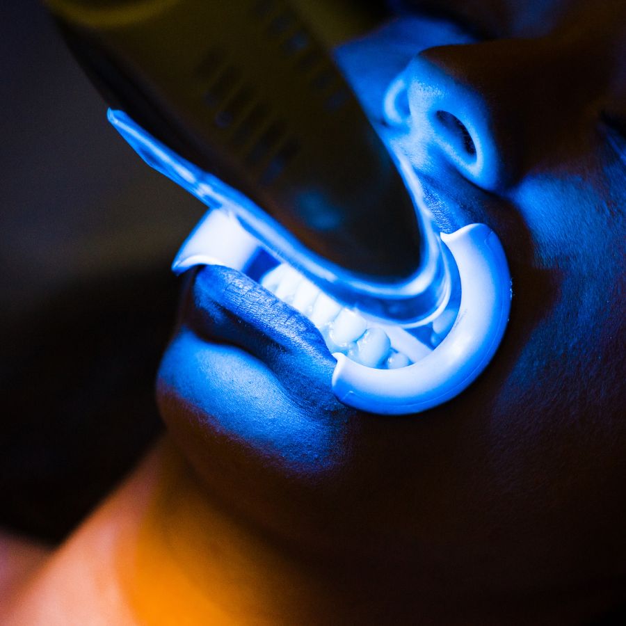 After undergoing the Zoom! the whitening process at ROC Dental Group, you're now sporting a brighter, more radiant smile.