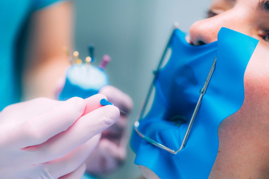 At ROC Dental Group, we're experts in non-surgical root canal treatments, designed to preserve your natural smile and provide essential relief from dental pain caused by serious decay or infection.
