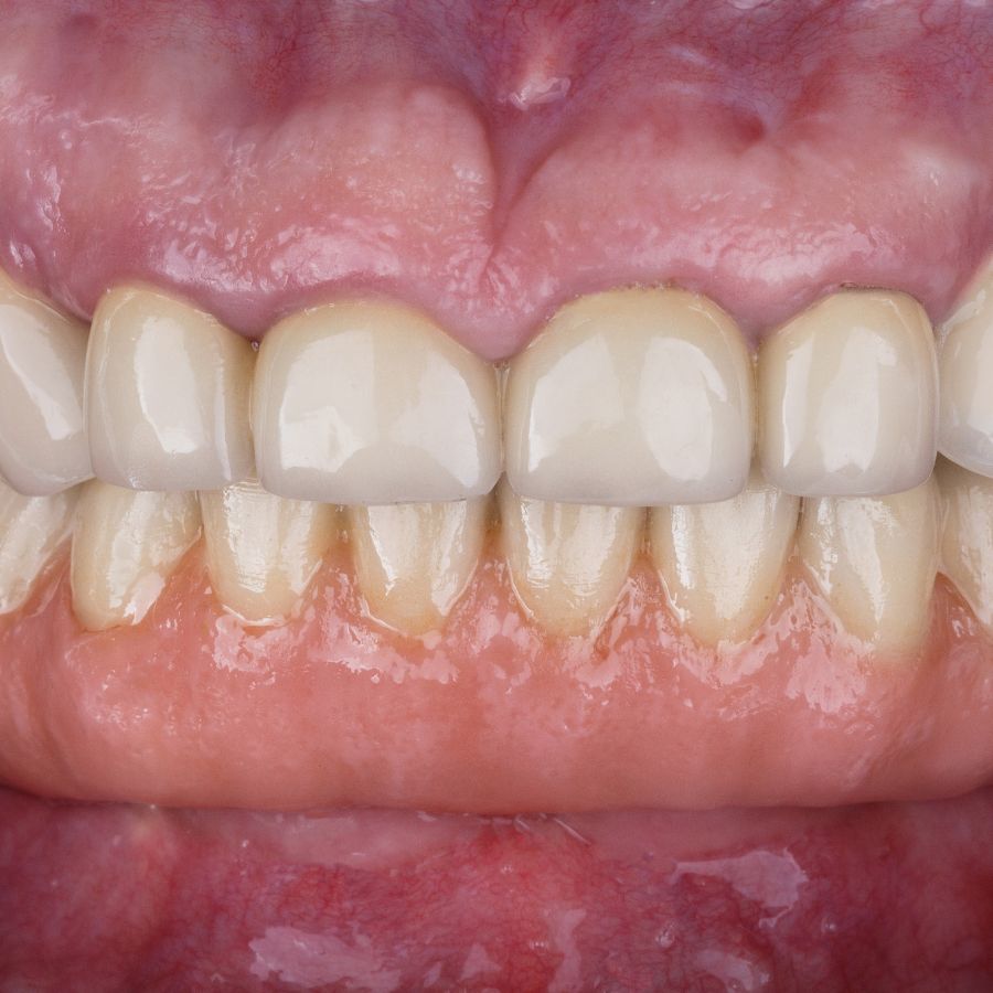 Maneuvering the world of non-surgical TMJ treatment options may seem intimidating, but we're here to help simplify the process.