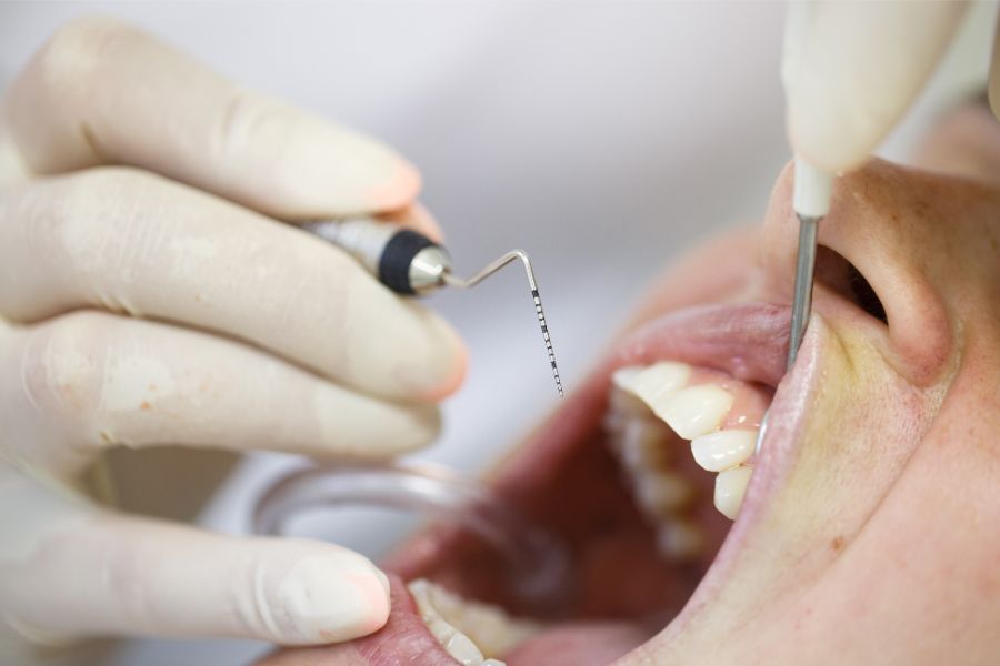 At ROC Dental Group, we provide extensive periodontal therapy services tailored to unique dental health needs.