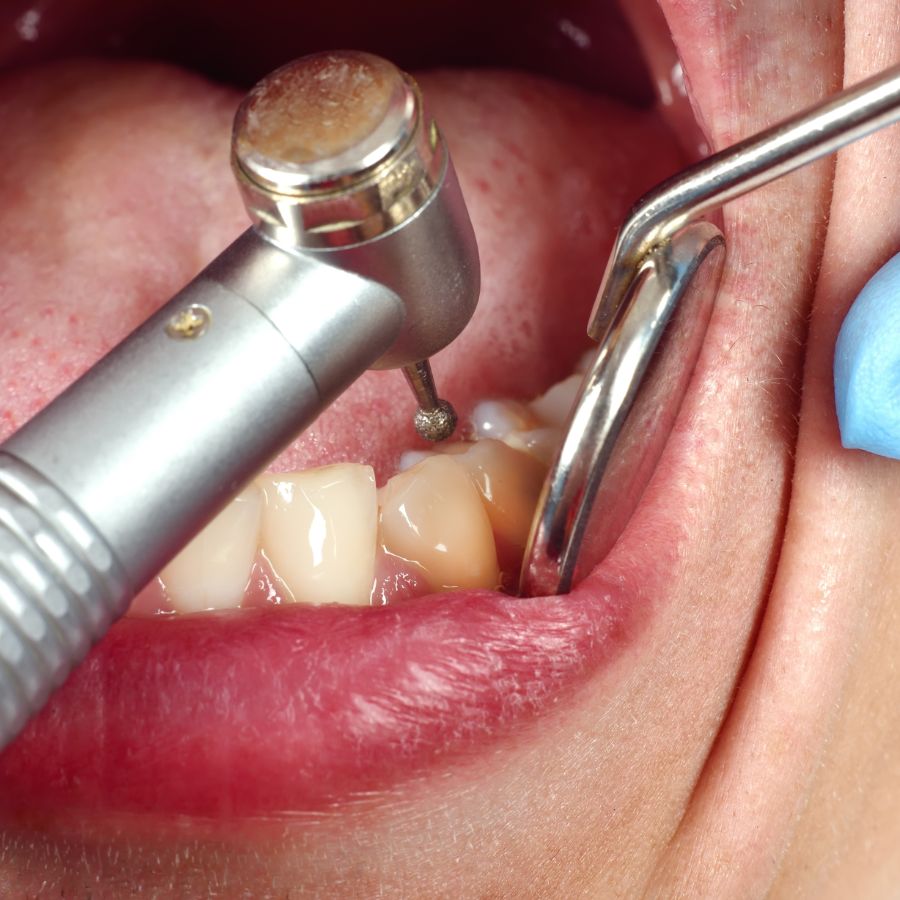 When it comes to maintaining a healthy smile, we believe in the power of prevention.
