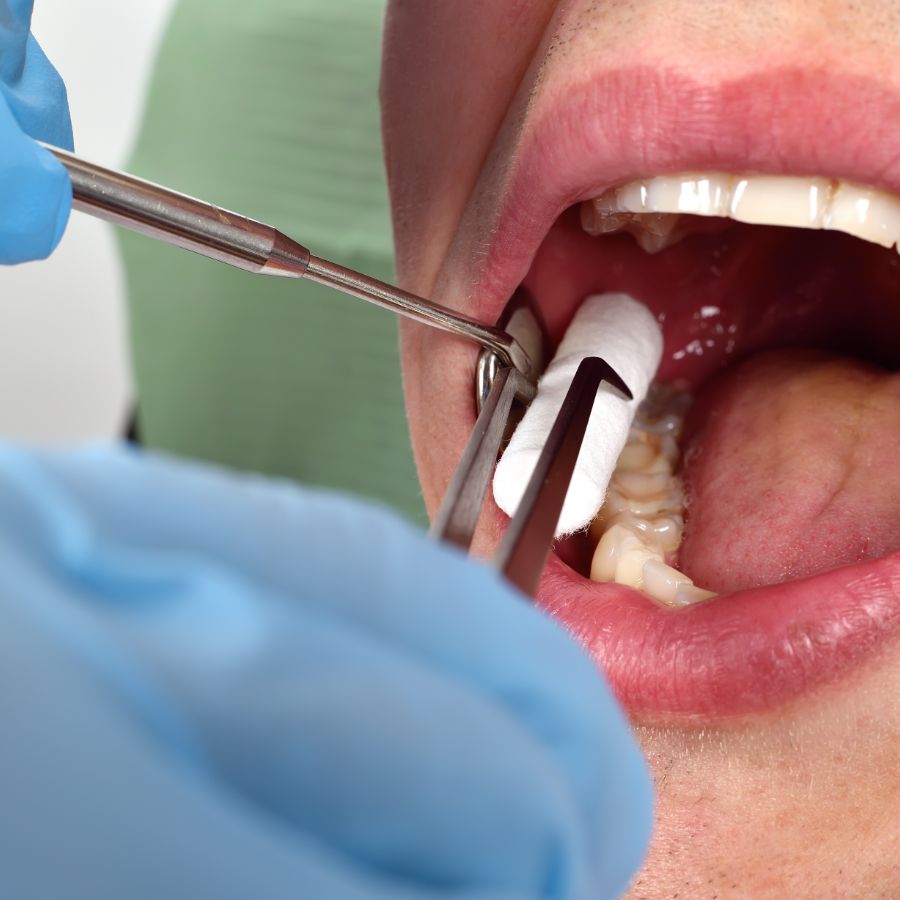 Diving into the heart of our services at ROC DENTAL, we offer an array of preventive and restorative procedures that maintain and improve your oral health.