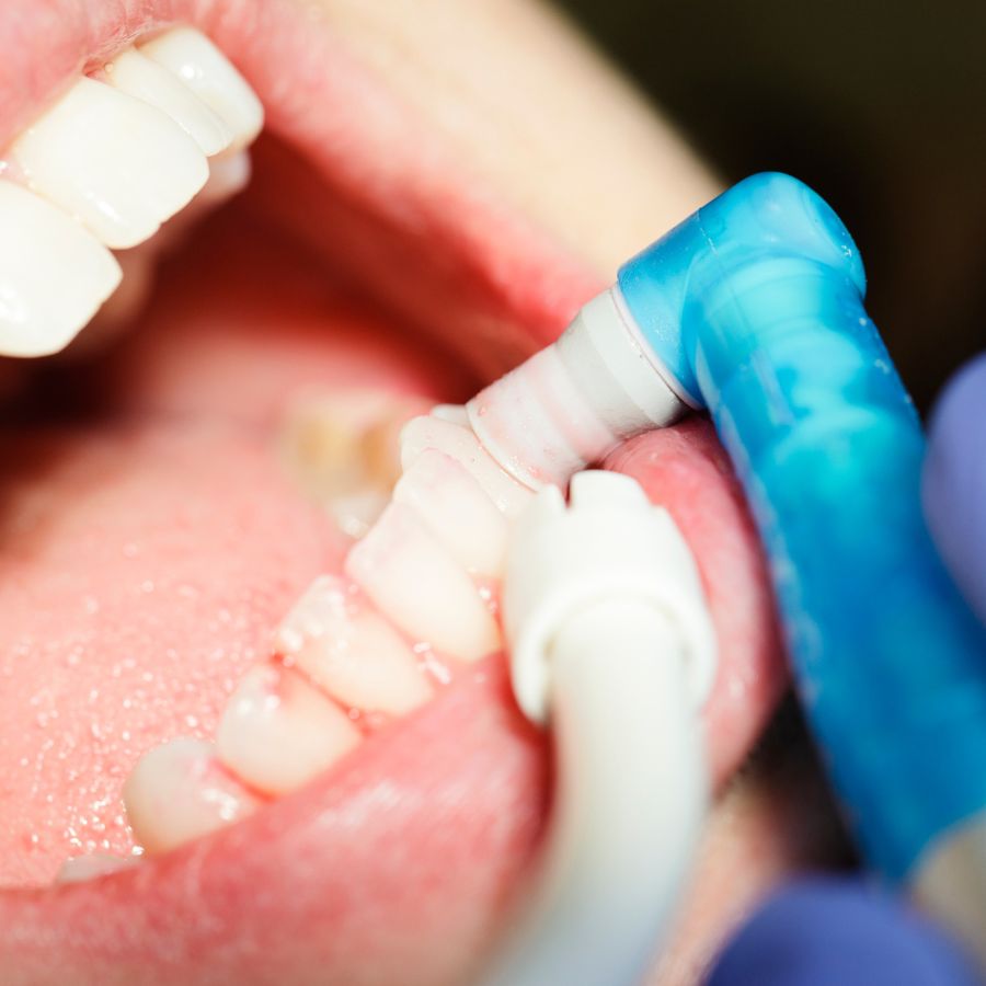 At ROC DENTAL, we’re proud to offer a wide range of preventive and cosmetic dental services to our Lobeco community.