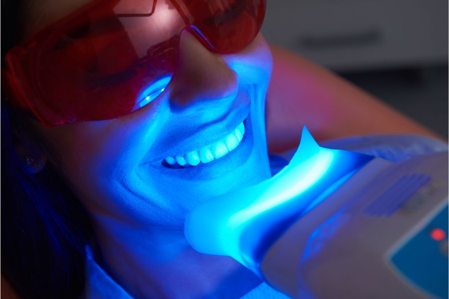 At ROC Dental Group, we offer top-rated professional teeth whitening services, including the highly sought-after Zoom!