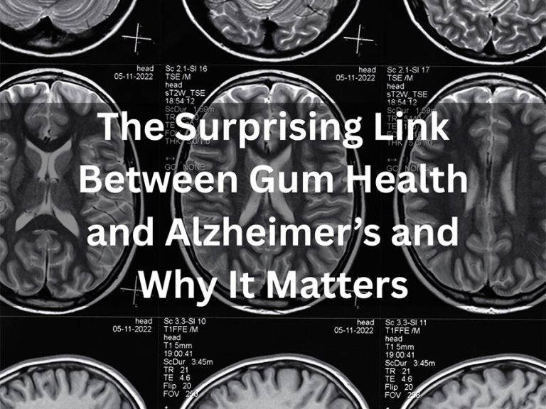 The Surprising Link Between Gum Health and Alzheimer’s and Why It Matters